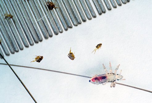 Lice and fleas are tiny wingless insects that can infest humans and their homes.