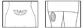 The best place for SUBCUTANEOUS INJECTION - Illustration