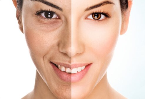 The less attention we pay to eating a healthy skin diet, the more problems we may see cropping up with our skin.