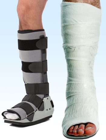 Picture 3 shows the type of casts used to treat Achilles tendon injury.