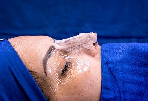 Forehead Flap Surgery