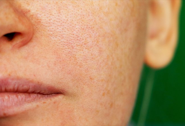 skin discoloration causes