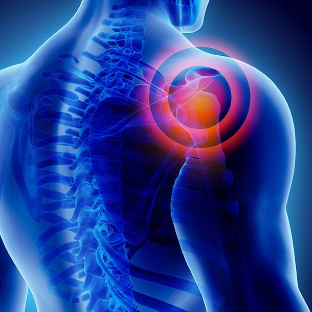 Muscle Pain