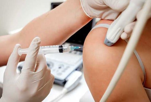 Your doctor might suggest this method if physical therapy and medication have not helped.