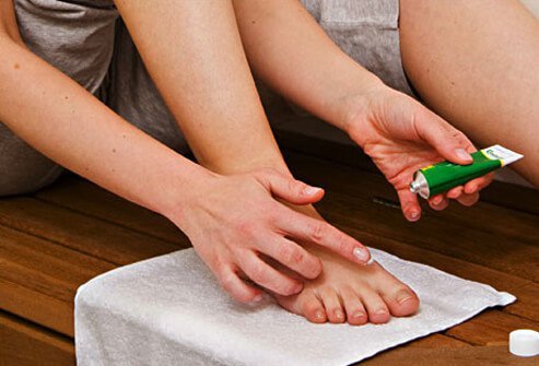 If you need fungal infection treatment, talk to your doctor.