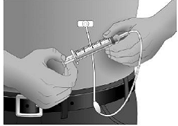 Repeat priming and needle insertion steps - Illustration