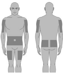 Select location of infusion sites - Illustration