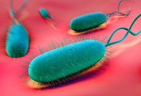 H. pylori is a common cause of gastric carcinoma.