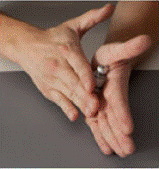 Remove the plastic dosing syringe from the package - Illustration