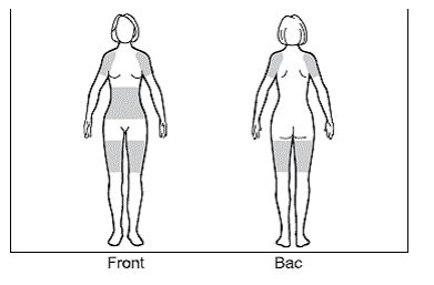 Apply GELNIQUE only to 1 of the shaded areas shown in the figure below: - Illustration