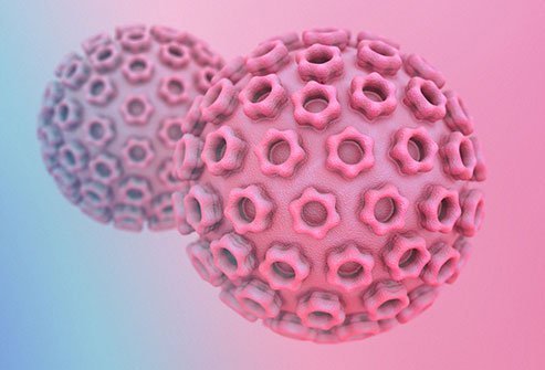 Genital sores or genital ulcers can occur because of several causes, the most common being sexually transmitted infections (STIs).