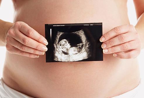 Pregnant moms who have active herpes may be advised to deliver via C-section to protect the baby.