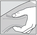 Rest the heel of your hand holding the syringe against your skin at the injection site. Insert the needle at a 90 degree angle straight into your skin. - Illustration