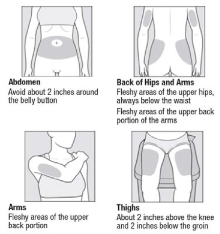 Choose the injection area - Illustration