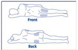 Choose the injection site - Illustration