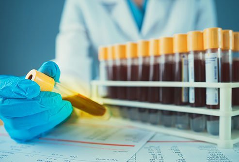 The golden blood type or Rh null blood group contains no Rh antigens