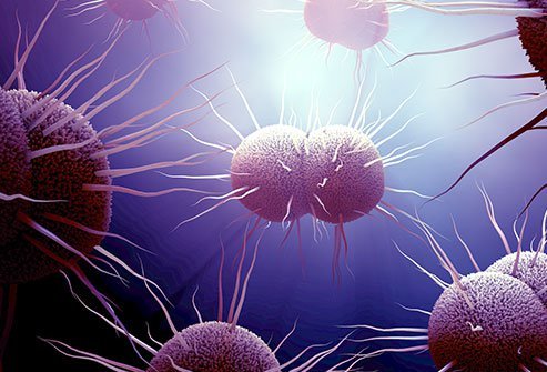  Picture of Gonorrhea Bacterial Infection