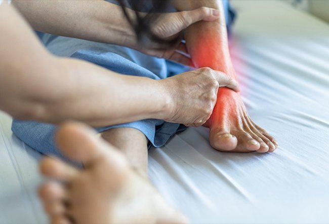 what is the fastest way to get rid of gout?