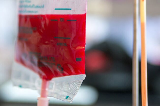Hemophilia happens in people who lack one of two other important clotting factor proteins. 
