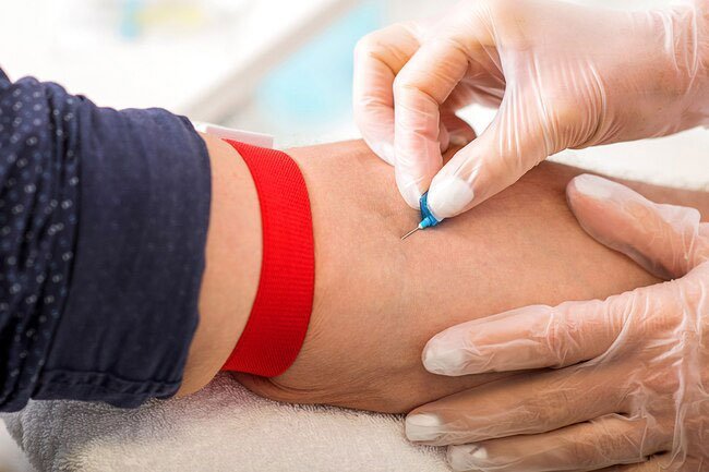 Blood tests can tell if your blood cell counts are in the normal range.