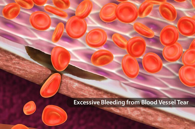 A missing or faulty protein causes von willebrand disease.
