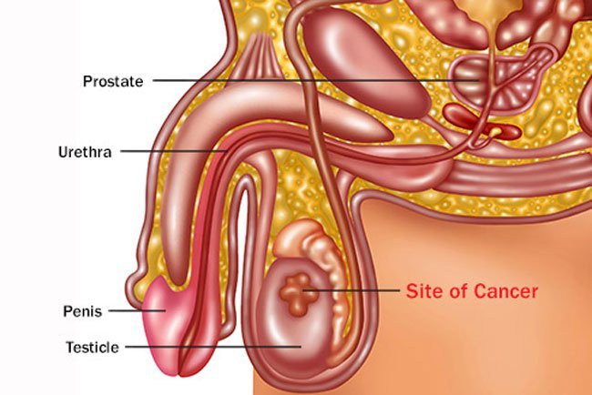 Like most other parts of your body, they can get cancer.