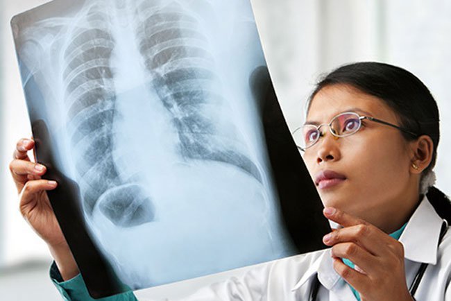 It helps your doctor decide the kind of treatment you will need.