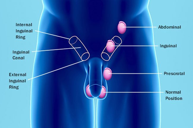 Before birth, the testicles develop in a babys belly. They usually drop into the scrotum by the time they're