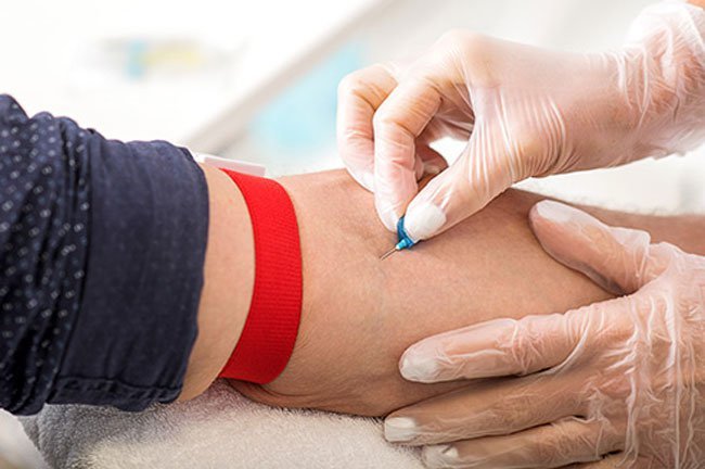In many cases, men find a lump on their own or their doctor finds one during a routine exam.