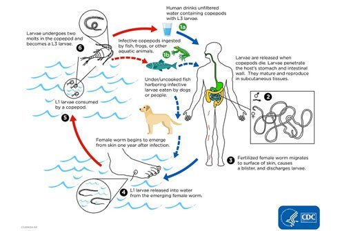 There is no medication to treat guinea worm disease or a vaccine to prevent infection. 