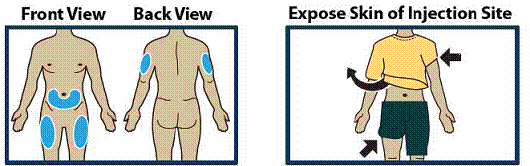 Remove any clothing covering the injection site - Illustration