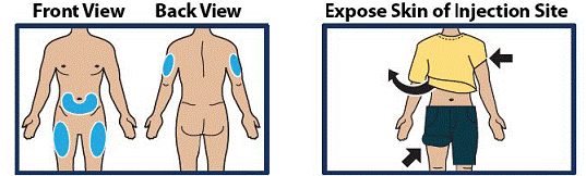 Choose Injection Site and Expose Bare Skin - Illustration