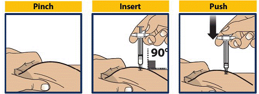 Pinch, Insert and Push to Start Injection - Illustration