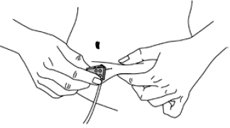 Insert the needle into the fold of skin - Illustration