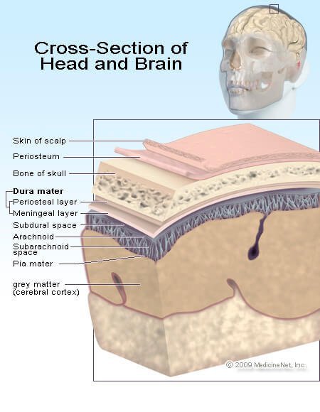 Picture of the brain and potential brain injury areas.