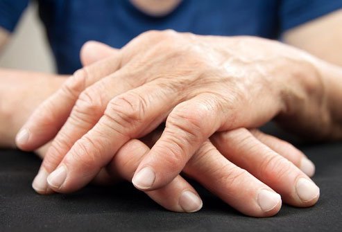 Cinnamon reduces inflammation and may help conditions like rheumatoid arthritis.