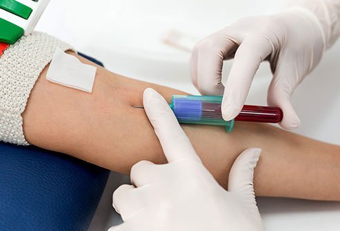 Your doctor tests you for these along with HDL and LDL.