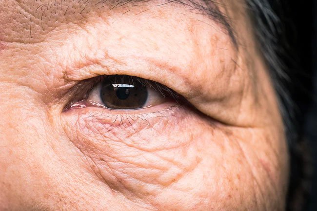 Grapes contain chemicals that reduce inflammation and help protect your eyes against cataracts and glaucoma.
