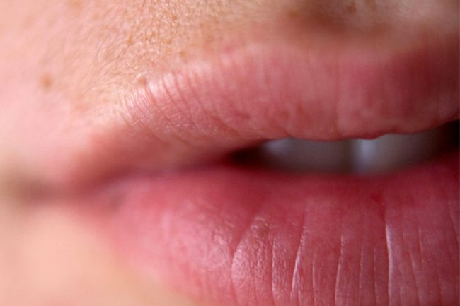 Bromelain in pineapple may cause your mouth to tingle or burn temporarily.