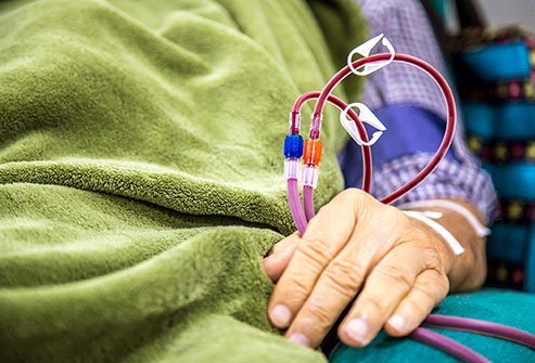 Hemodialysis and peritoneal dialysis are different ways to filter the blood.