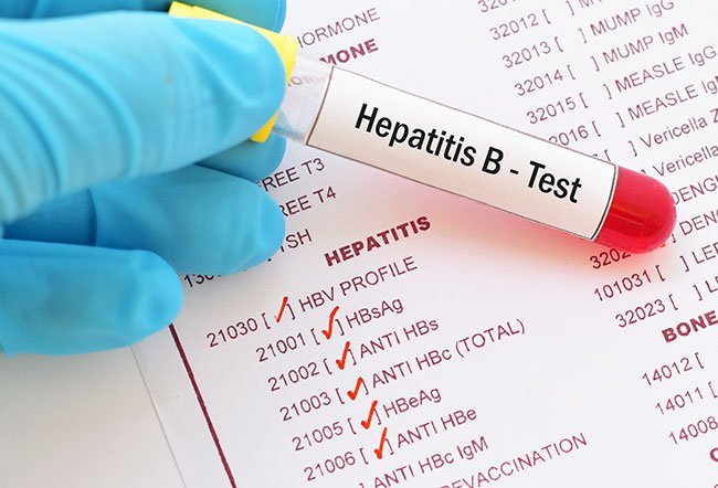 normal range for hepatitis B surface antibody test