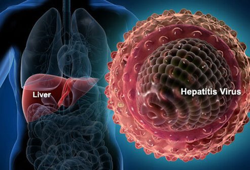 Hepatitis