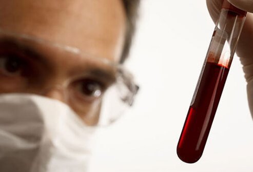 Hepatitis Diagnosis