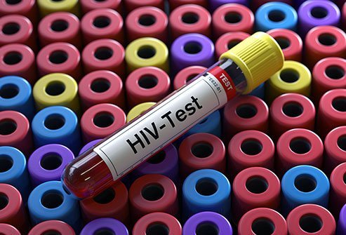 Every adult can benefit from undergoing HIV testing at least once.