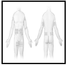 Select injection site - Illustration