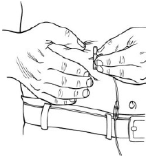 HIZENTRA, Immune Globulin Subcutaneous (Human) Figure 4 Illustration