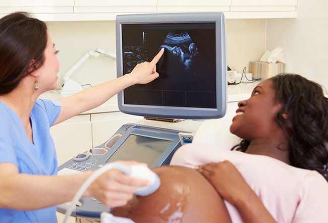 The first pregnancy ultrasound is usually done within the first trimester, in the first twelve weeks of pregnancy.