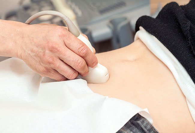 Ovarian teratomas diagnosis