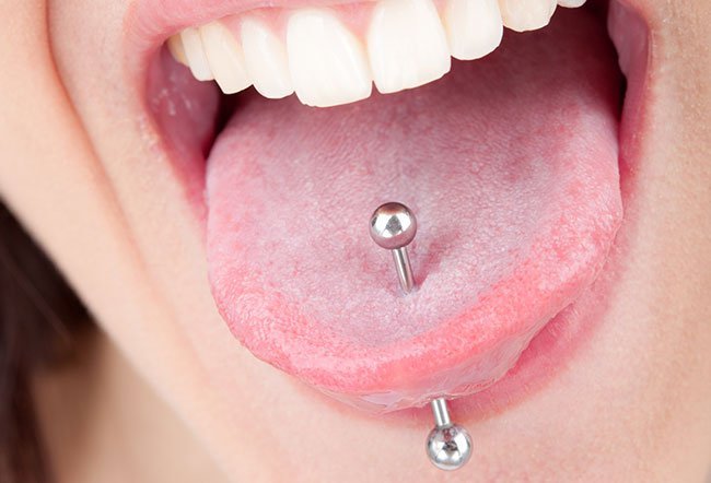 Tongue piercing as a form of body piercing has become quite popular as a fashion trend.