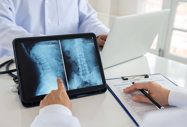Can You Become Paralyzed From Herniated Disc Surgery